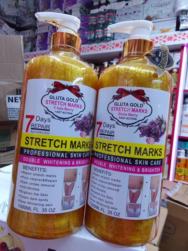 Stretch Marks - main view