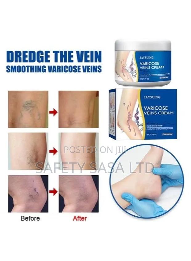 Vericose Vein Cream - thumbnail 4