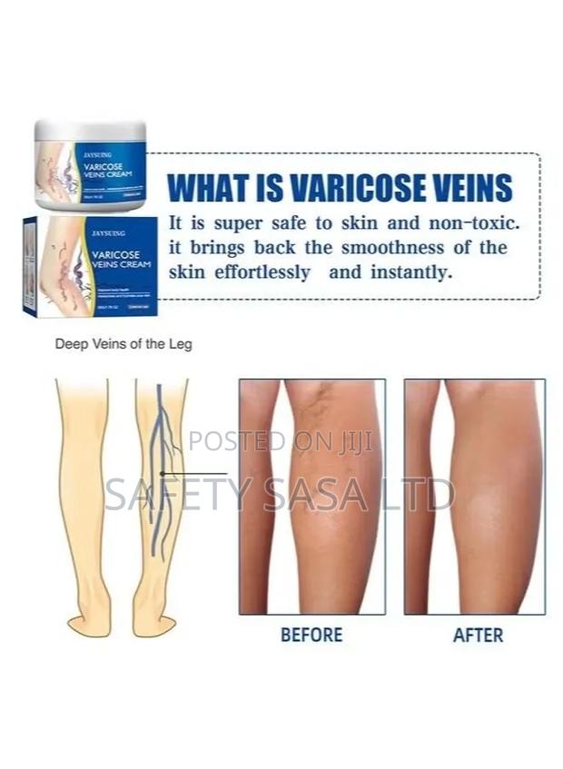 Vericose Vein Cream - thumbnail 5