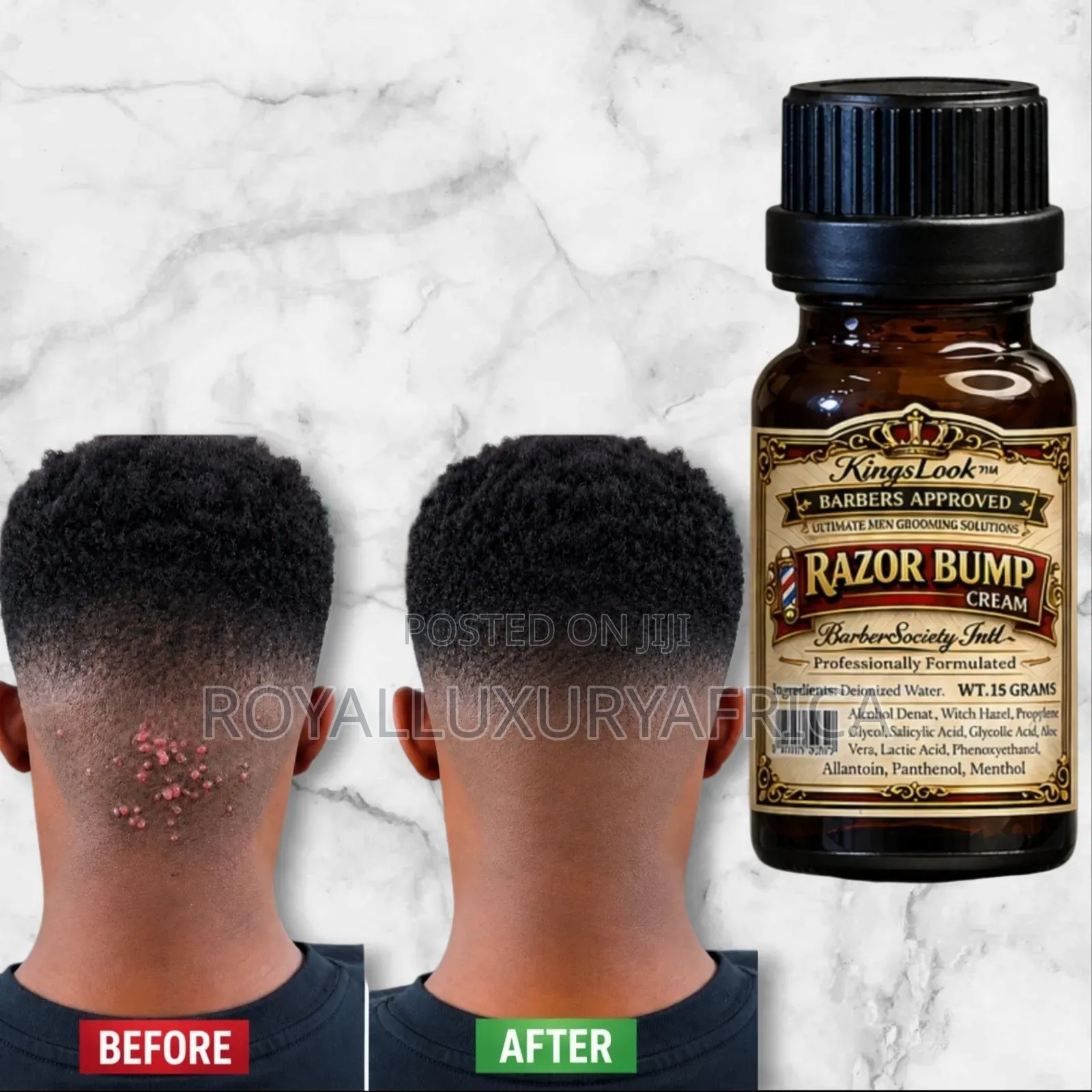 Razor Bump Cream