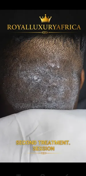 Razor Bump Cream