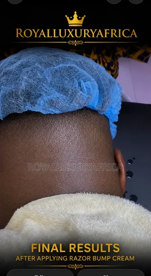 Razor Bump Cream