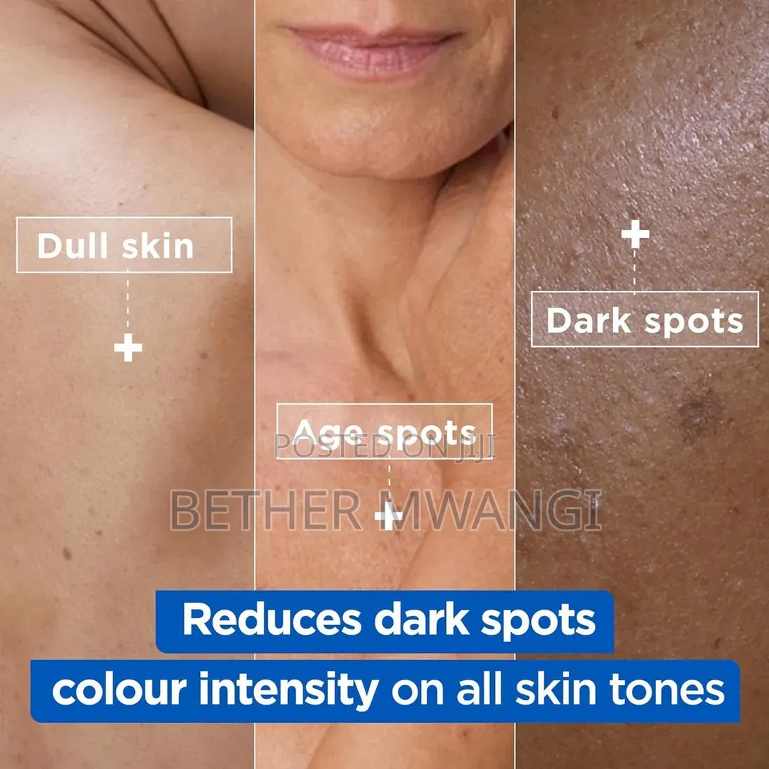 Mixa Niacinamide Bright Moisturising Anti-Dark Spot Cream