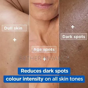 Mixa Niacinamide Bright Moisturising Anti-Dark Spot Cream