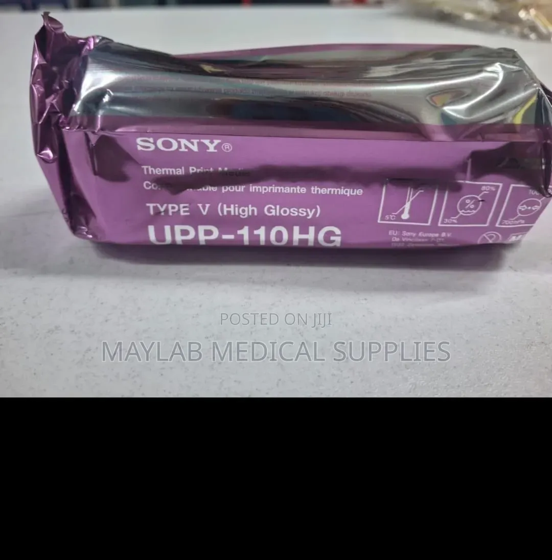 Sony Thermal Paper Rolls – Medical Ultrasound Printer Paper