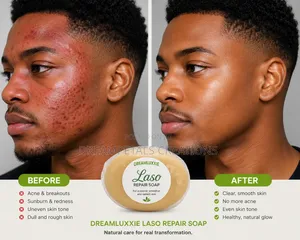 Healing/Repair Skin Soap