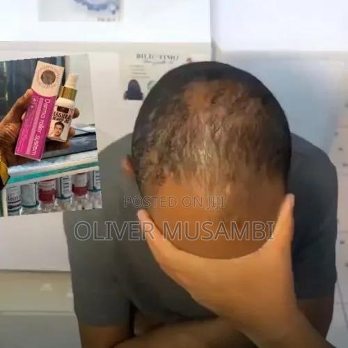 Rogaine Minoxidil Spray - thumbnail 2
