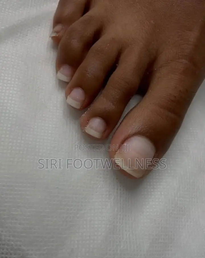 Foot Care Services