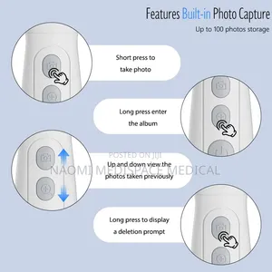 2600mAh Video Otoscope