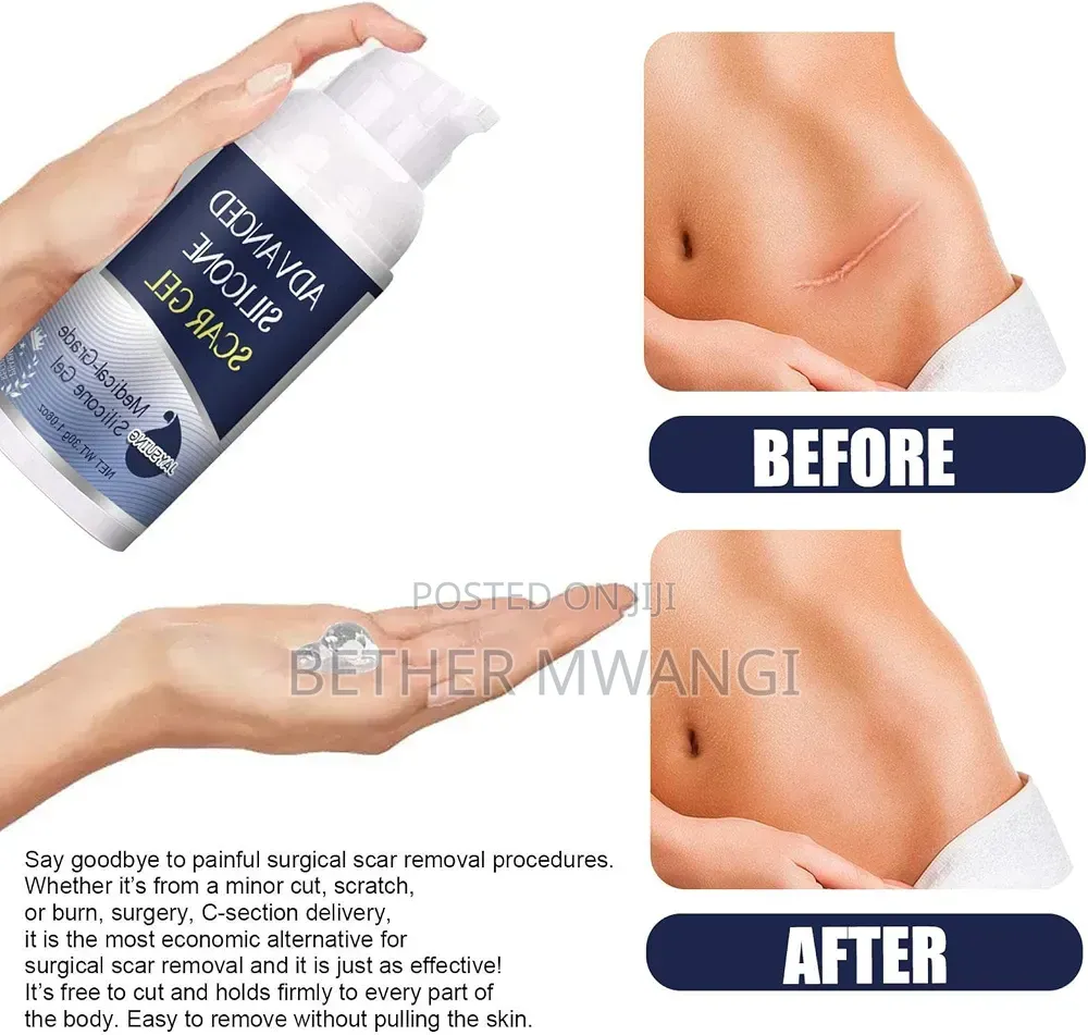 Advanced Silicone Scar Gel in Kenya