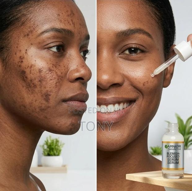 Improve Your Looks