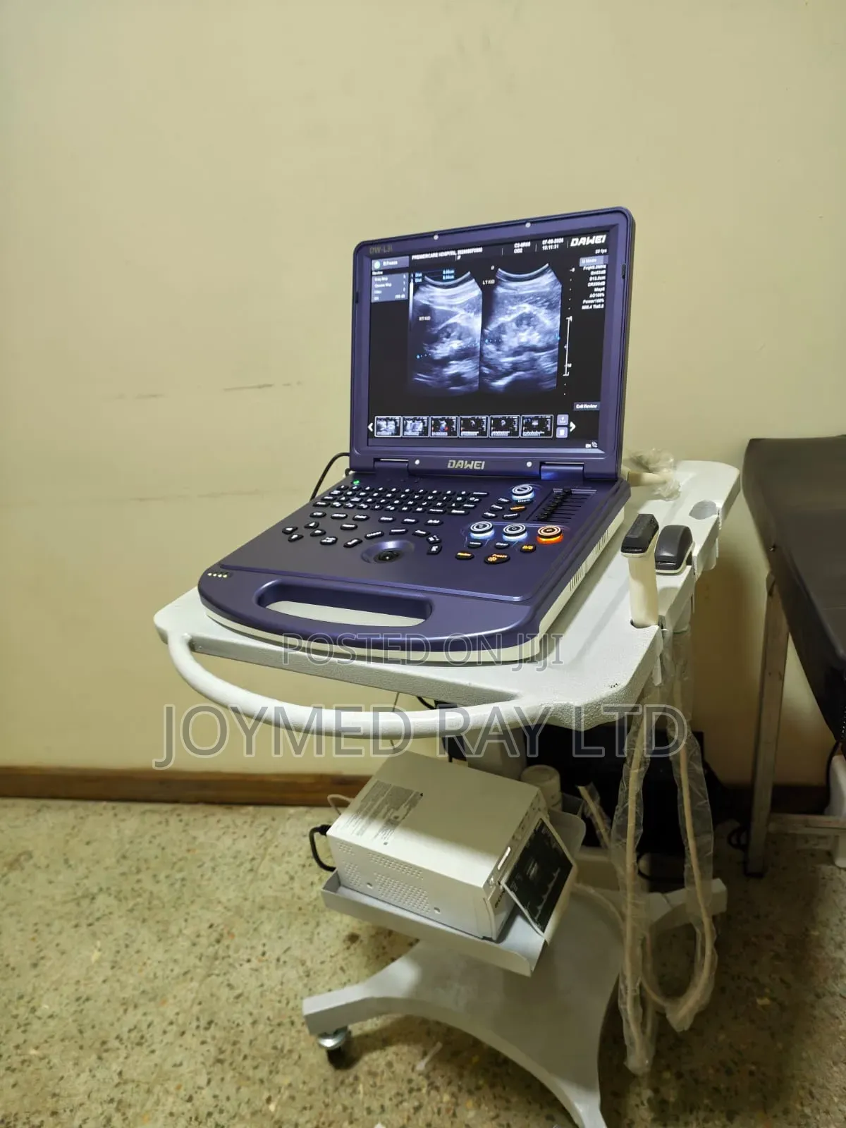 Colour Doppler Ultrasound Machine