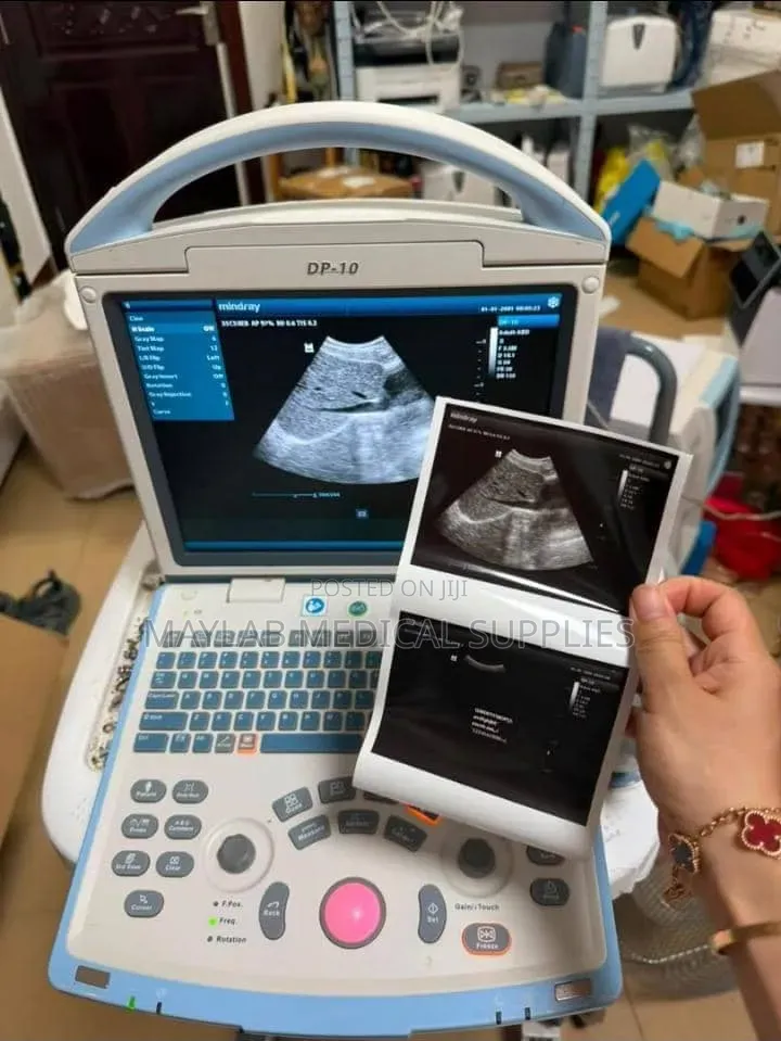 Mindray DP-10 Ultrasound Machine – Portable Digital Ultrasound System