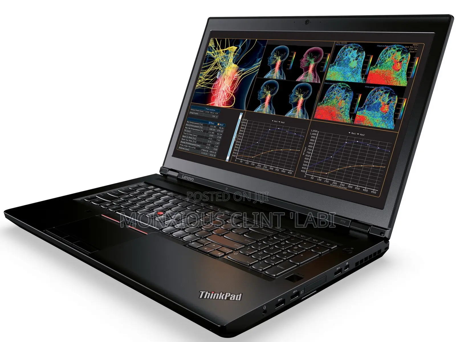 Laptop Lenovo ThinkPad P70 64GB Intel Core i7 SSD 2T