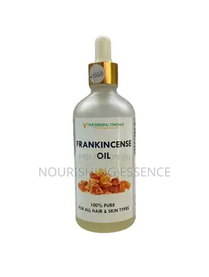 Frankincense Oil