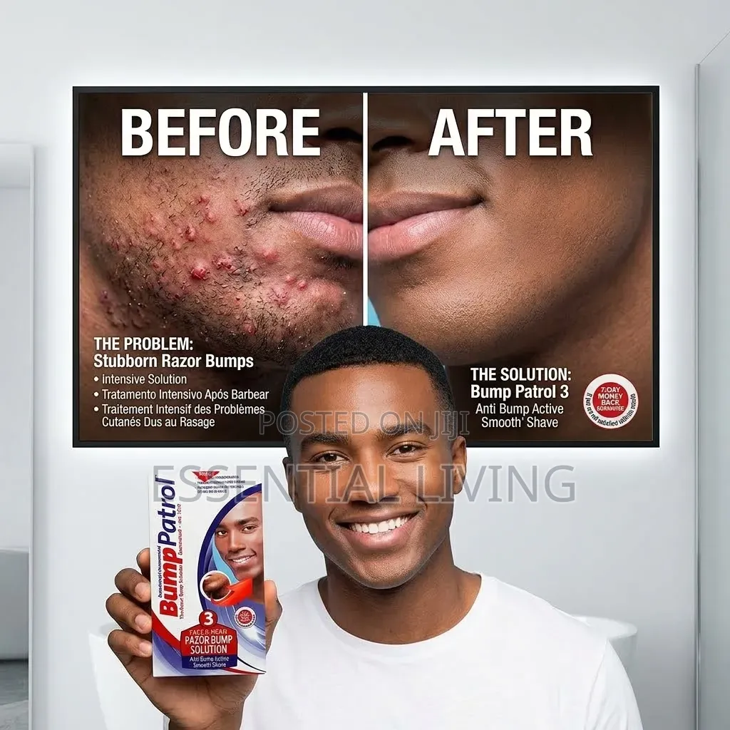 Bump Patrol Razor Bump Solution - Face, Chin & Head
