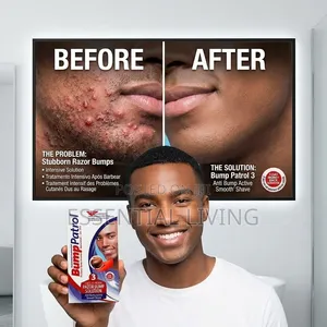 Bump Patrol Razor Bump Solution - Face, Chin & Head