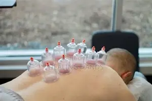 Hijama Therapy
