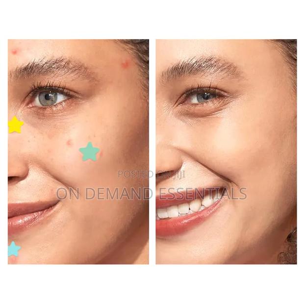 Acne / Pimple Patch Star Design - thumbnail 3