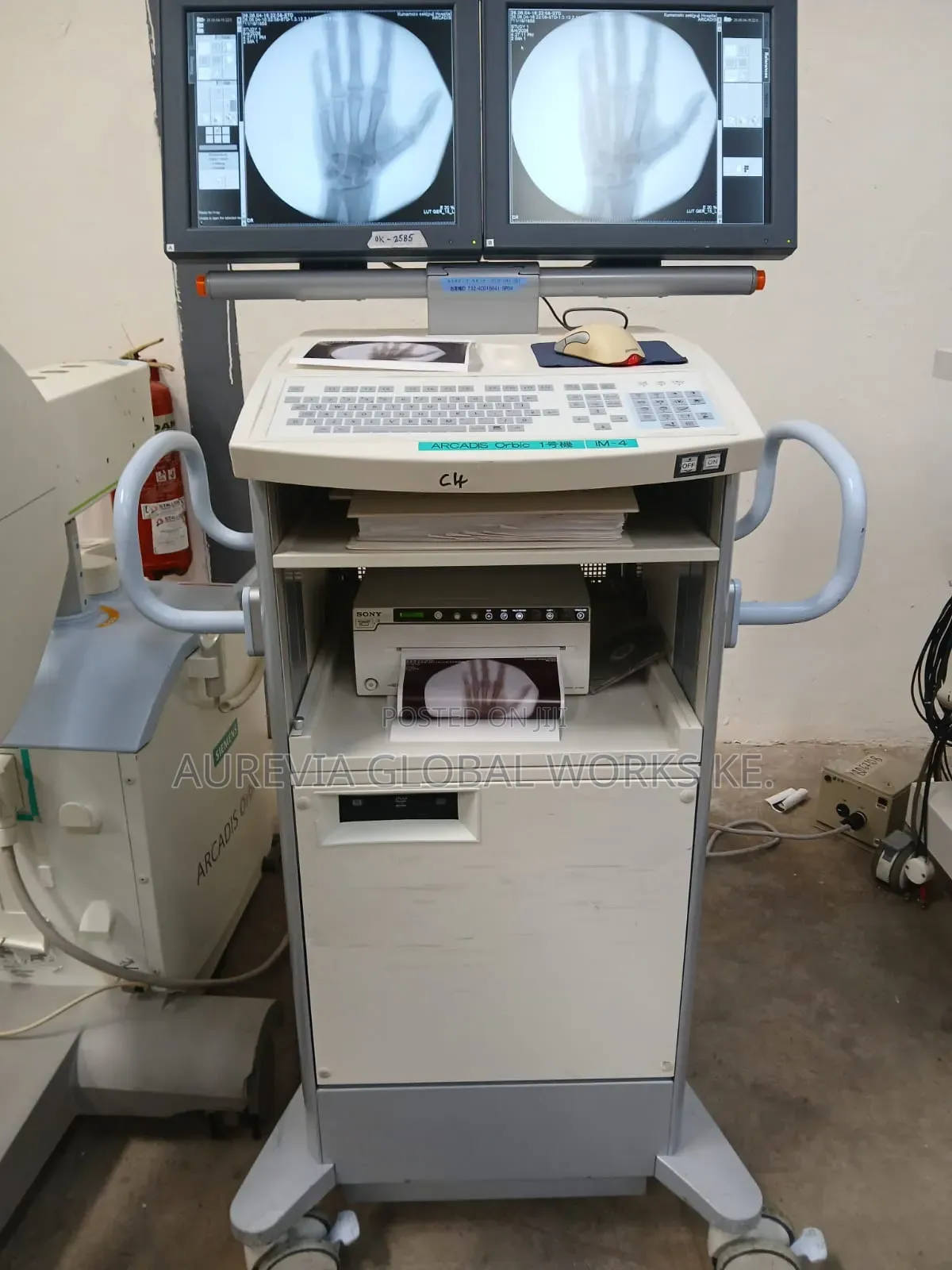Mobile C‐arm Fluoroscopy System.