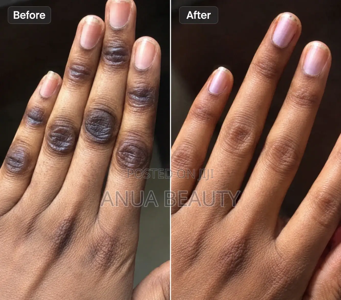 Anua Beauty Korean Knuckle Cream