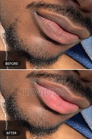Pinkish Looking Lips Cream