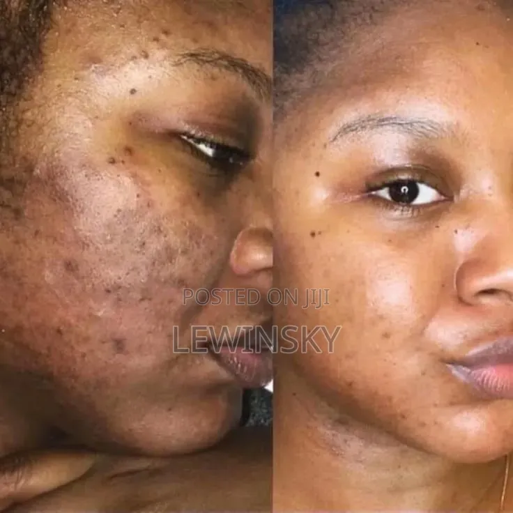Brightening Face Cream